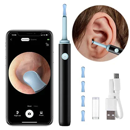 STRELLO STORE™   - PROFESSIONAL EAR WAX REMOVAL TOOL