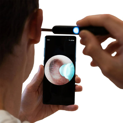 STRELLO STORE™   - PROFESSIONAL EAR WAX REMOVAL TOOL