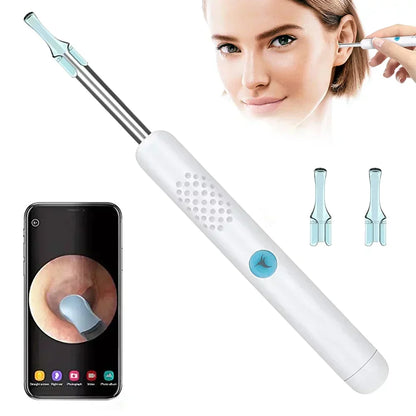 STRELLO STORE™   - PROFESSIONAL EAR WAX REMOVAL TOOL
